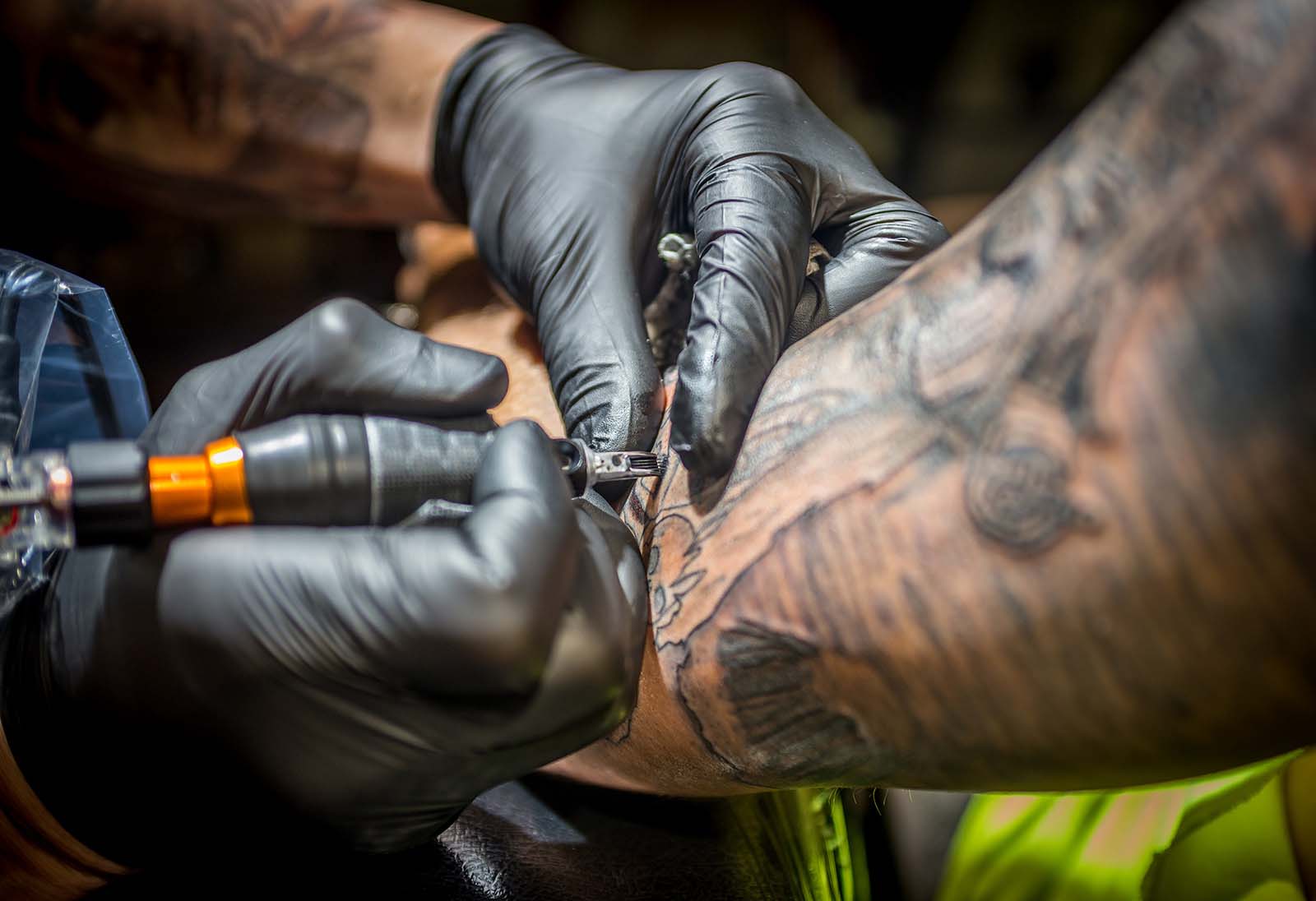 Reasons to Consider Tattoo Removal in Long Island